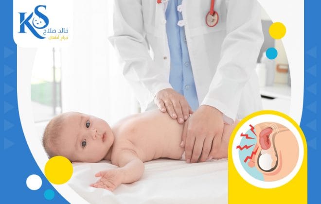 علاج الفتق الأربي بدون جراحة عند الأطفال