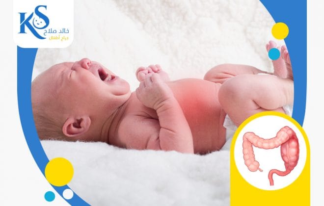 اعراض مرض هيرشسبرينج عند الرضع 2 أعراض مرض هيرشسبرينج عند الرضع