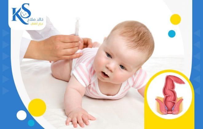 علاج انسداد فتحة الشرج 3 علاج انسداد فتحة الشرج