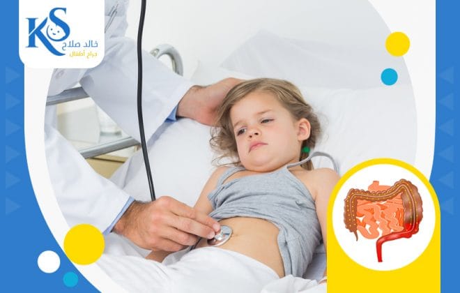 علاج تضخم القولون عند الاطفال 2 علاج تضخم القولون عند الاطفال