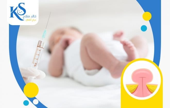 مضاعفات عملية الفتق الإربي عند الأطفال