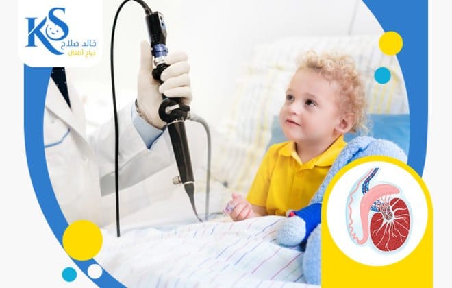 عملية-الخصية-المعلقة-باالمنظار