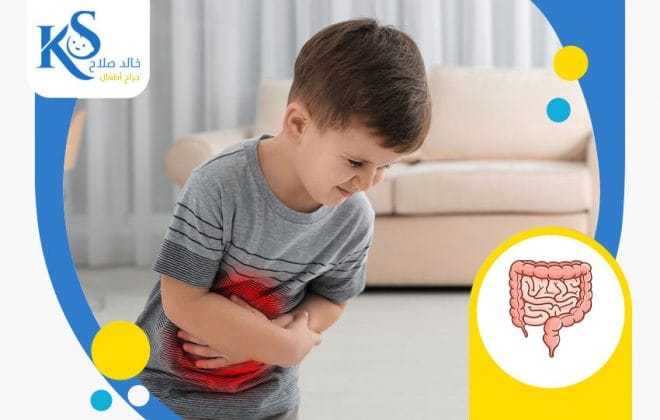 اسباب تضخم و توسع القولون عند الأطفال