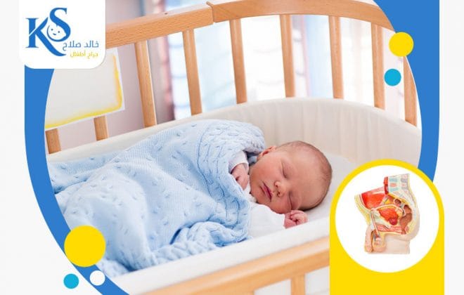 هل هناك فرق بين بروز سرة المولود والفتق الاربي عند الرضع؟ 2 بروز سرة المولود