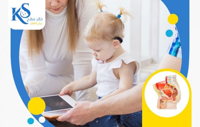 تشوهات المهبل عند الاطفال 3 تشوهات المهبل عند الاطفال