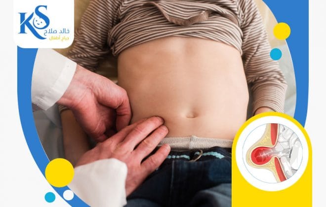 ما بعد عملية الفتق الاربي