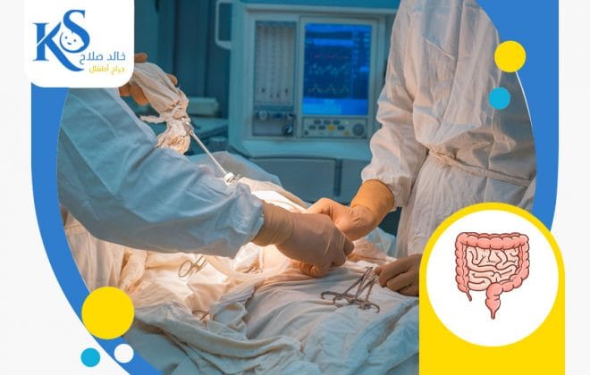 هل عملية الفتق خطيرة