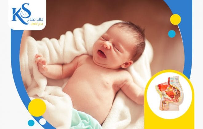 معلومات حول الفتق الإربي عند الأطفال 4 معلومات حول الفتق الإربي عند الأطفال