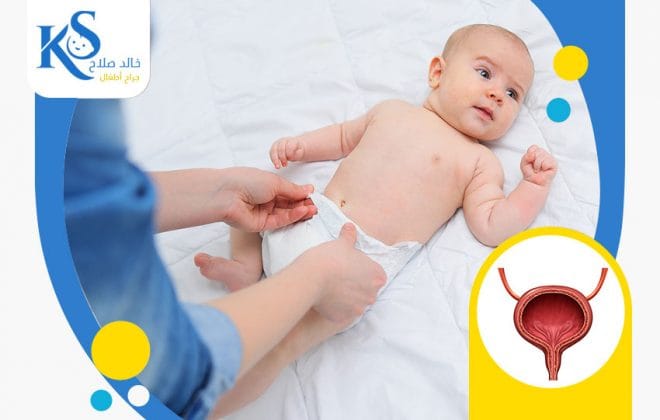 علاج صغر المثانة عند الاطفال 4 طرق علاج صغر المثانة عند الاطفال