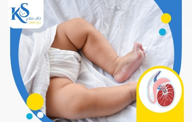 ما هي الخصية المعلقة عند الأطفال؟ 4 اعراض الخصية المعلقة عند الأطفال