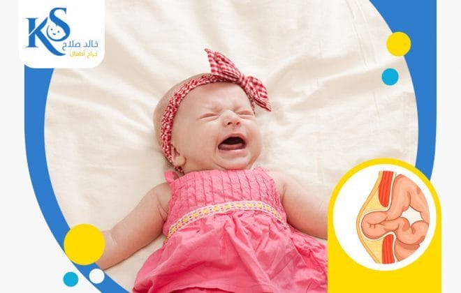 ما هي أعراض الفتق عند الأطفال البنات؟ 2 اأعراض الفتق عند الأطفال البنات