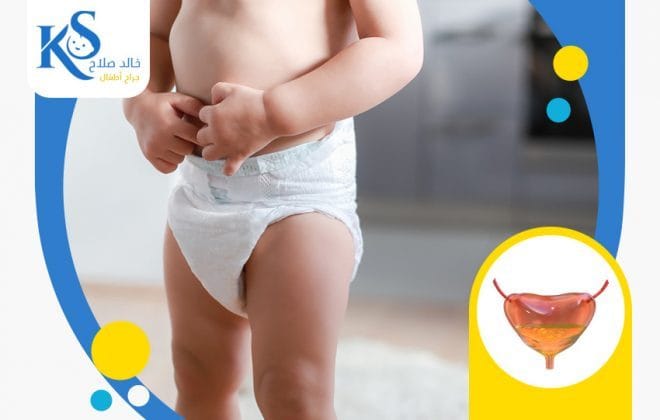 ما هي أنواع تشوه المثانة عند الأطفال