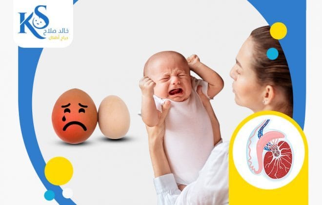 ما هي أسباب كبر حجم الخصيتين للمولود؟ 4 ما هي اعراض كبر حجم الخصيتين للمولود
