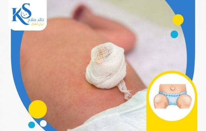 ما هو شكل الفتق عند الاطفال؟ 4 شكل الفتق عند الاطفال الرضع