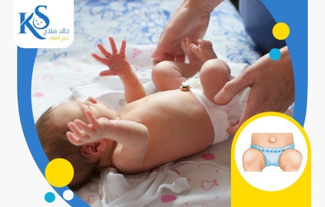 أنواع الفتاق عند حديثي الولادة وكيفية علاجه 2 عملية الفتاق عند حديثي الولادة