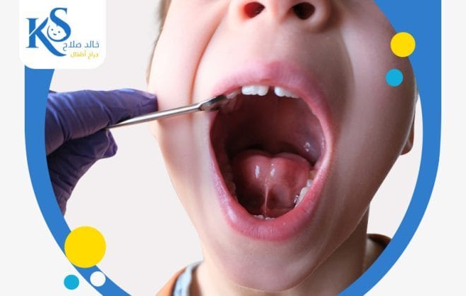 محطات هامة في تجاربكم مع اللسان المربوط للاطفال 3 تجاربكم مع اللسان المربوط للاطفال