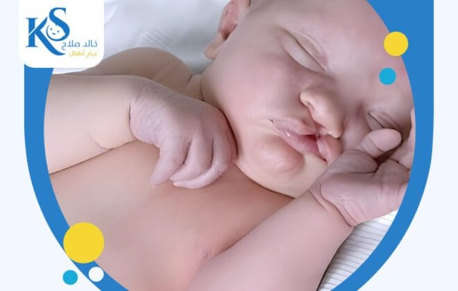 ما التحديات التي تواجه الأطفال ذوي الشفة الأرنبية؟ 3 ما التحديات التي تواجه الأطفال ذوي الشفة الأرنبية؟